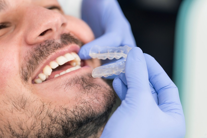 Invisalign orthodontist