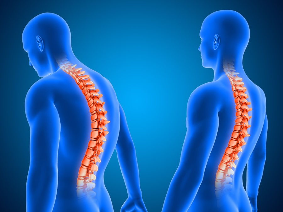 Spine Health